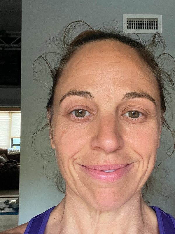 Customer before photo: front view of a smiling woman with her hair pulled back