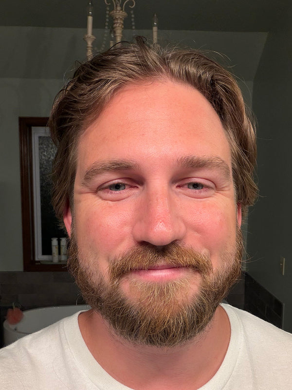 Customer before photo: front view of a smiling man with a full beard and wavy hair