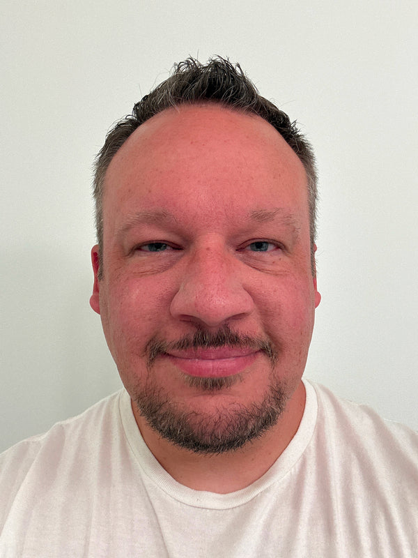 Customer before photo: front view of a man with short hair and a goatee