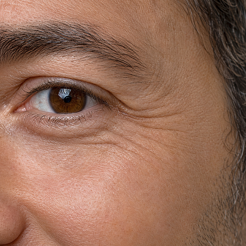 men's fine lines and wrinkles
